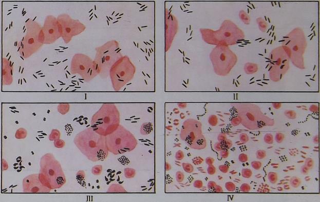 мазок у женщин на флору, вид под микроскопом