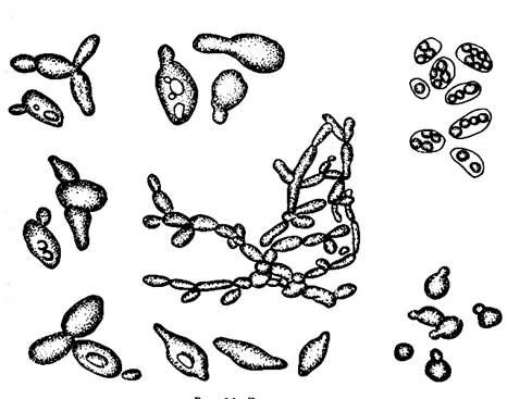 Рассмотрите рисунок с изображением дрожжей какое. Формы клеток дрожжей микробиология. Клетки дрожжей Ascomycota. Дрожжевые клетки микробиология. Строение дрожжей микробиология.