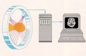 Компьютерная томография (КТ). Магнитно-резонансная томография